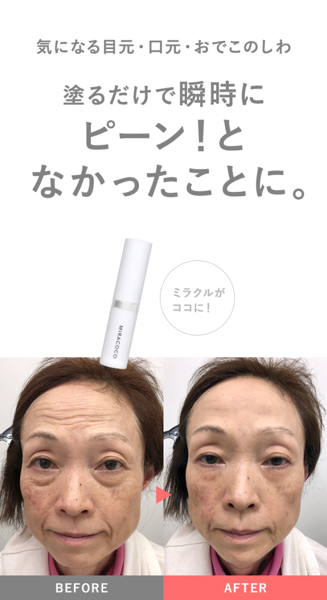 リンクルール　5g