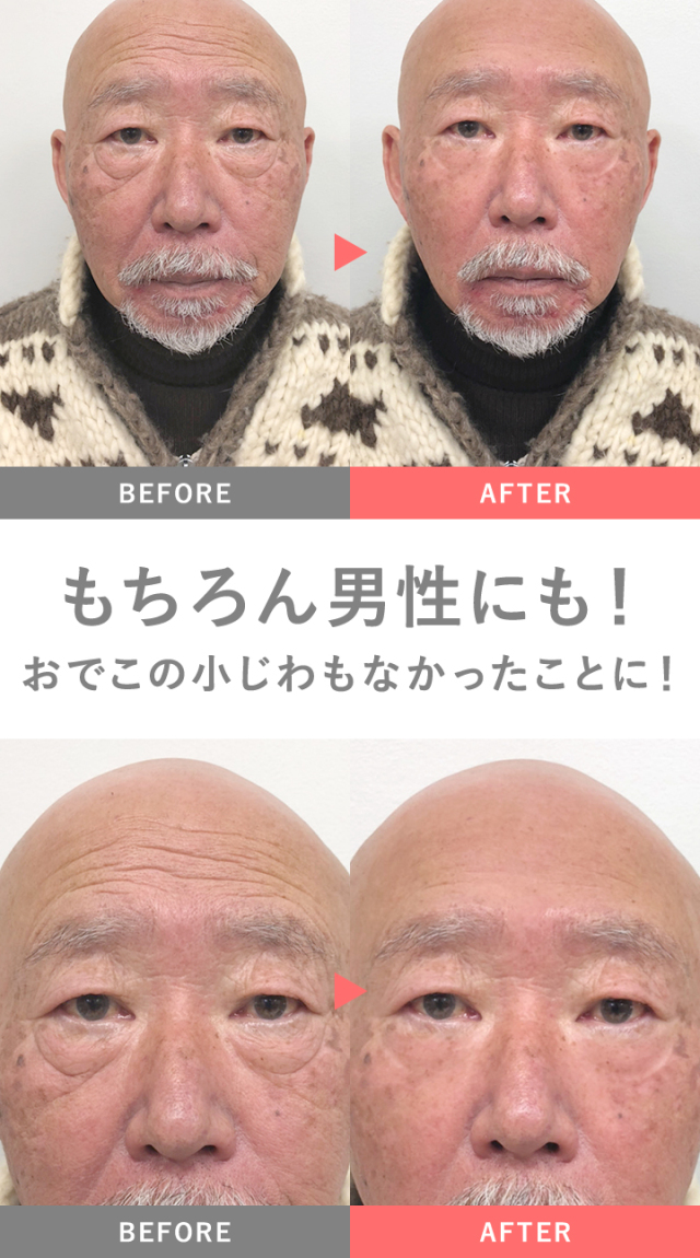 MIRACOCO ミラココ リンクルール 5g 【公式】【送料無料】｜ 目元ケア