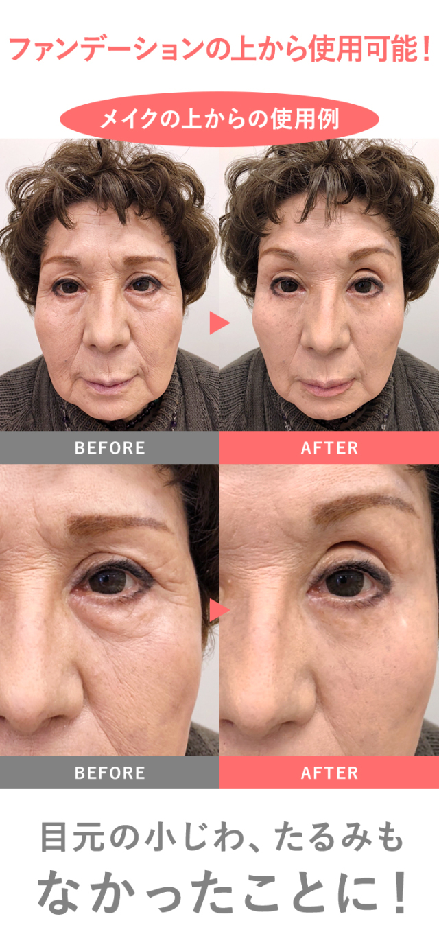 MIRACOCO ミラココ リンクルール 5g 【公式】【送料無料】｜ 目元ケア