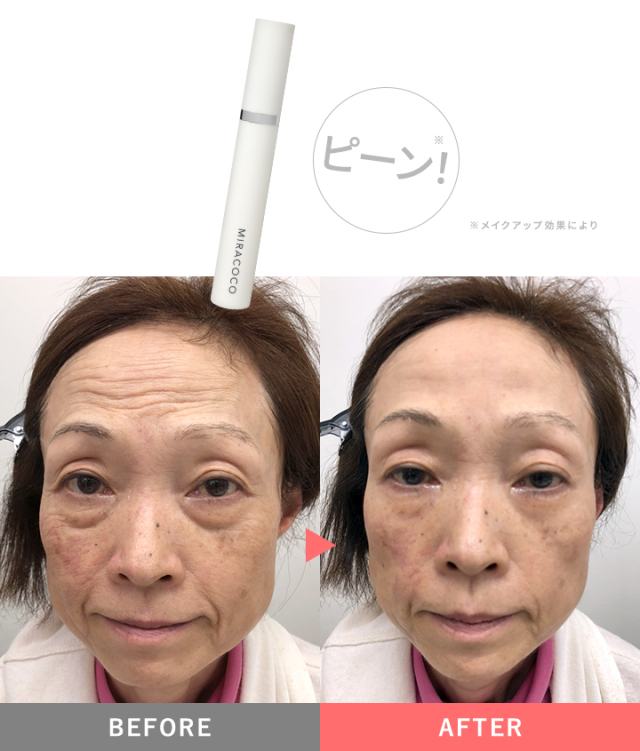 MIRACOCO ミラココ リンクルール プラス 15g