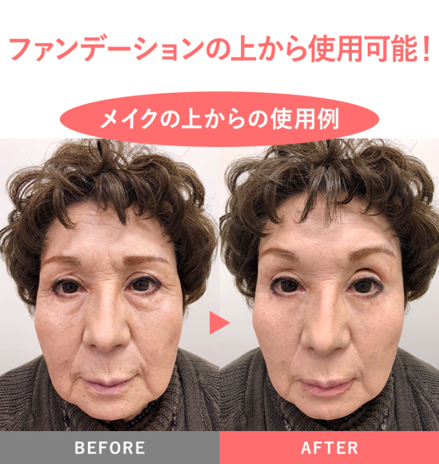 MIRACOCO ミラココ リンクルール プラス 15g