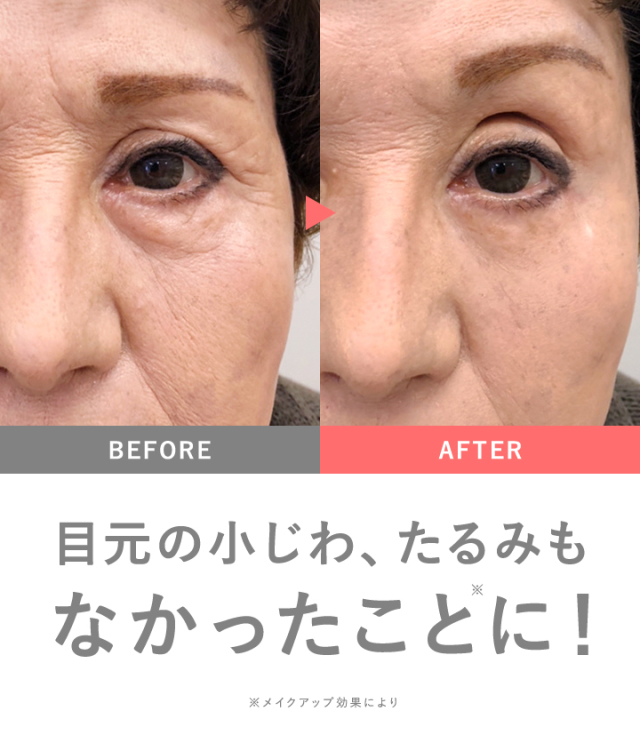 MIRACOCO ミラココ リンクルール プラス 15g