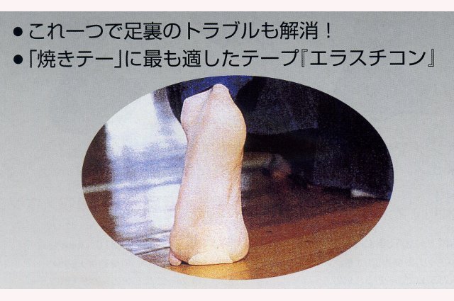 エラスチコン「焼きテー」