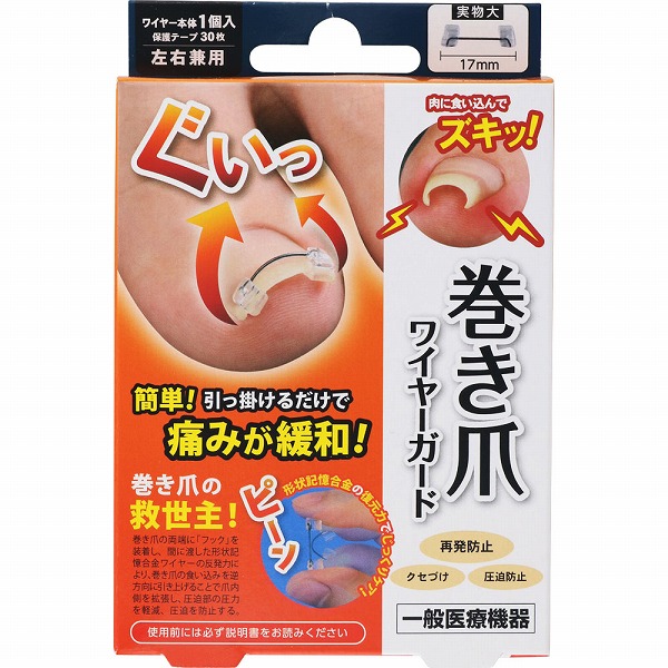 巻き爪ワイヤーガード(1セット) PP