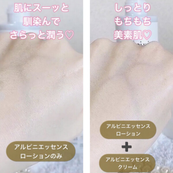 アルピ二エッセンスクリーム使用前使用後