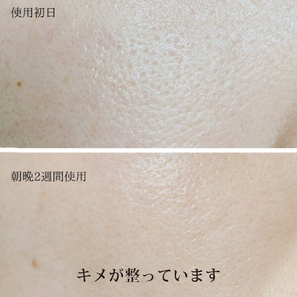 モリンガブライトミネラル化粧水