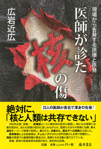 医師が診た核の傷 現場から告発する原爆と原発 広岩 近広 藤原書店