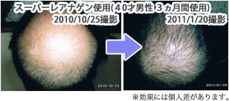 フルボ酸シャンプー｜ミアモンテSレアナゲン サロン専売商品