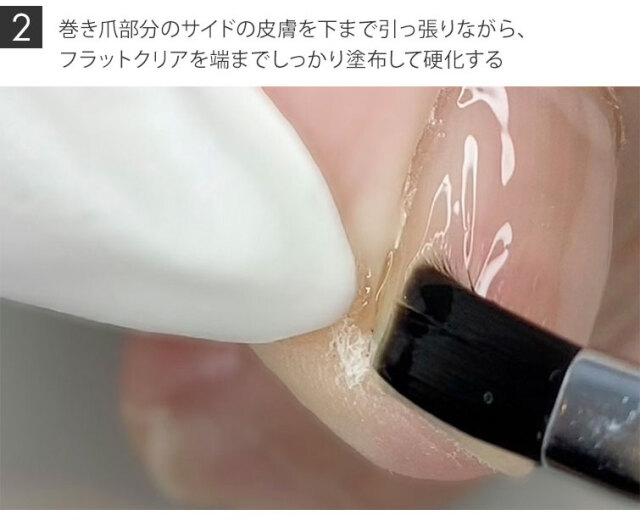 GRACE フラットクリア 5g