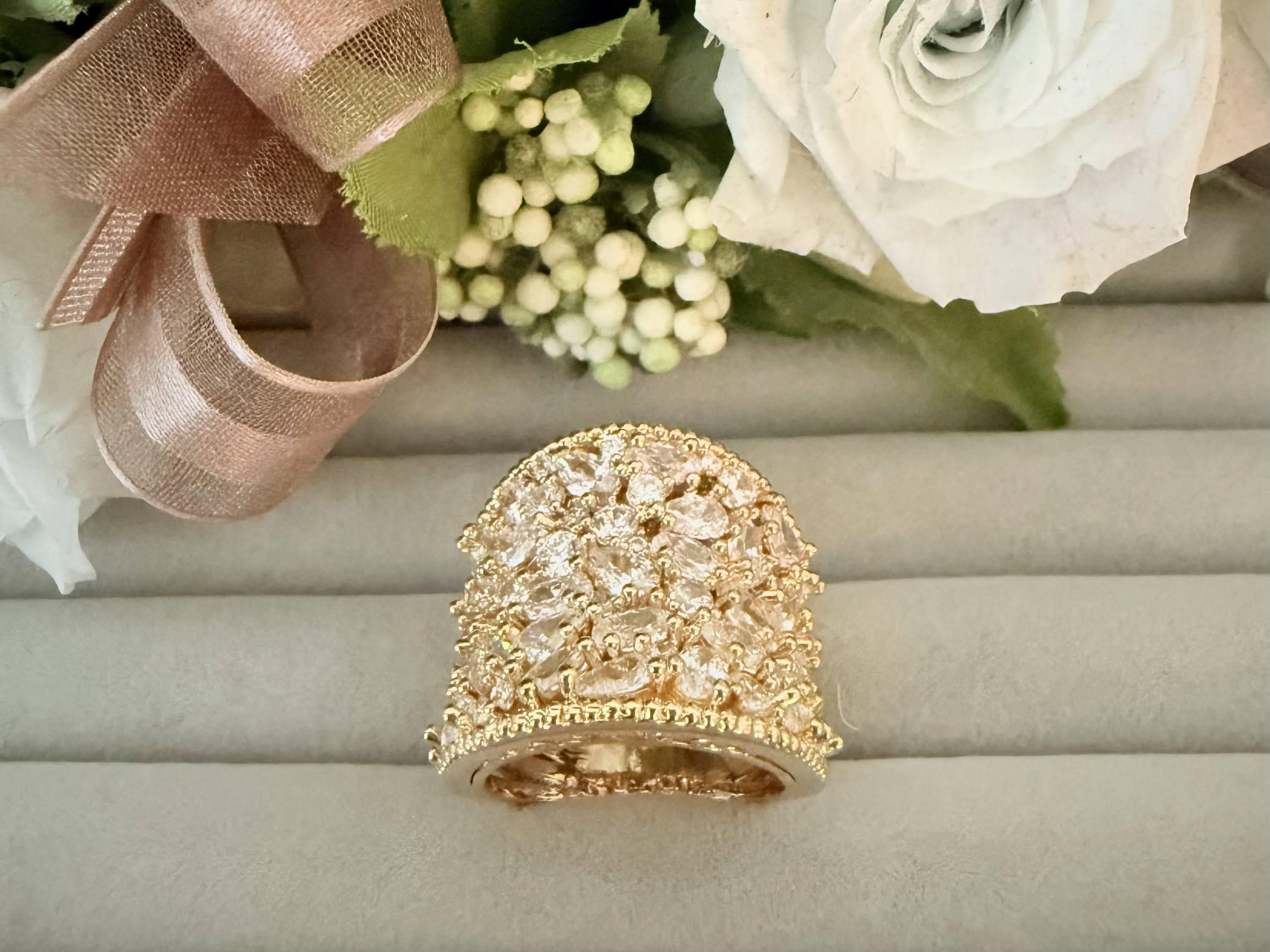 全面ボリュームリング