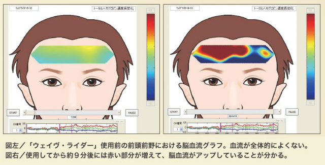 脳血流グラフ