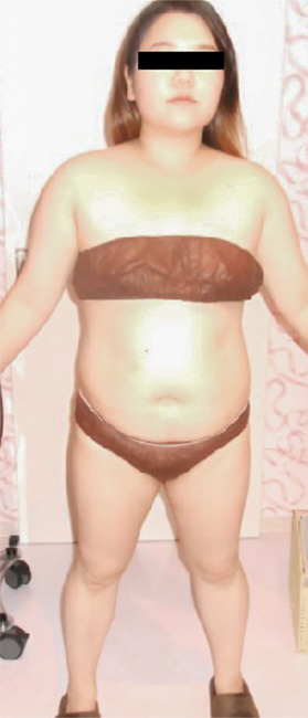 Before（全身）