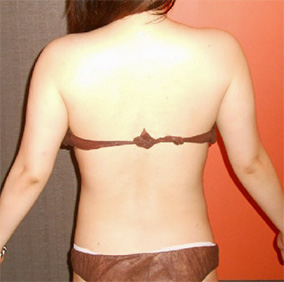 After（背中）