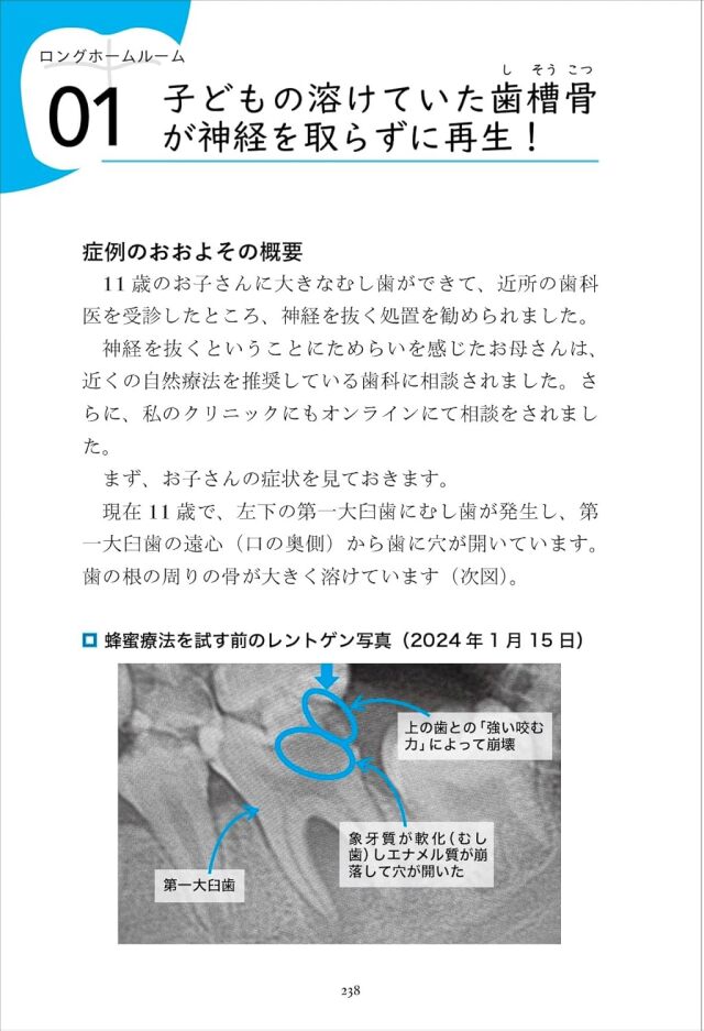 泉 ページ 歯科教科書 歯科手術アシスタント マスターBOOK (歯科衛生士ブックレット