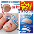巻き爪シール　2ヶ月☆貼るだけで巻き込む爪の進行を手軽にストップ　お悩みグッズ【メール便送料無料】