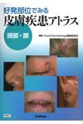 好発部位でみる皮膚疾患アトラス　頭部・顔
