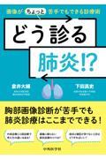 どう診る肺炎!?　画像が（ちょっと）苦手でもできる診療術