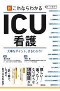 新・これならわかるICU看護