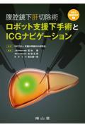 腹腔鏡下肝切除術　ロボット支援下手術とICGナビゲーション
