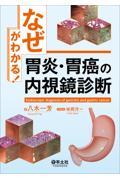 「なぜ」がわかる！胃炎・胃癌の内視鏡診断