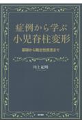 症例から学ぶ小児脊柱変形 基礎から難治性疾患まで