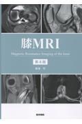 膝MRI　第4版