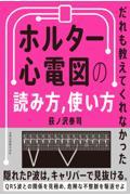 だれも教えてくれなかった　ホルター心電図の読み方、使い方