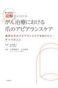 がん治療における爪のアピアランスケア