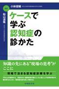 ケースで学ぶ　認知症の診かた