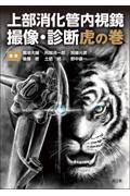上部消化管内視鏡　撮像・診断虎の巻