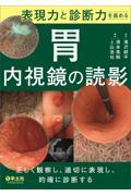 表現力と診断力を高める　胃内視鏡の読影