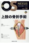 新OS NEXUS No.19  上肢の骨折手術