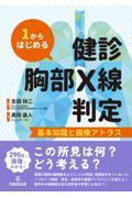 1からはじめる健診胸部Ｘ線判定　基本知識と画像アトラス