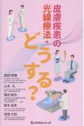 皮膚疾患の光線療法・どうする？