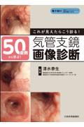 50症例から学ぶ！これが見えたらこう診る！気管支鏡画像診断