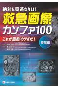 絶対に見逃がさない！ 救急画像カンファ100(腹部編) これが読影のツボだ！