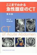 ここまでわかる急性腹症のCT　第4版