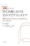 がん治療における爪のアピアランスケア