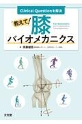 Clinical Questionを解決　教えて！膝バイオメカニクス