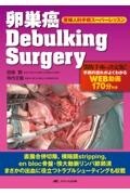 卵巣癌　Debulking Surgery