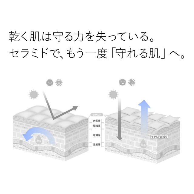 乾く肌は守る力を失っている。