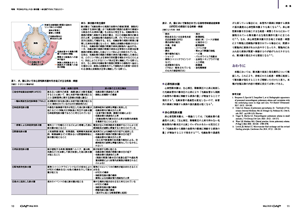 cap2305sample1.jpg?t=