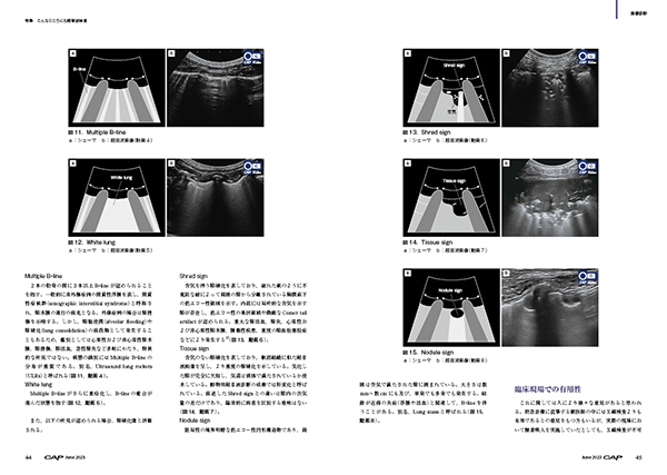 CAP 2023.1～6月　獣医学雑誌　裁断済 CAP 2023.1～6月 獣医学雑誌 裁断済 画像診断（冊子＋電子閲覧権）