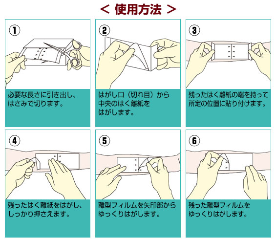 ニチバン カテリープラスロール 50mm 10m Cpsr0510 医療テープ