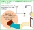 座薬挿入器Ｂ説明