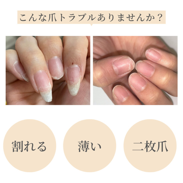 【正規通販】 ネイル OPI エンビー オリジナル 15ml NAILENVY ネイルエンビー オーピーアイ ストレングスナー エンヴィー 透明 オリジナルフォーミュラ ネイリスト セルフ