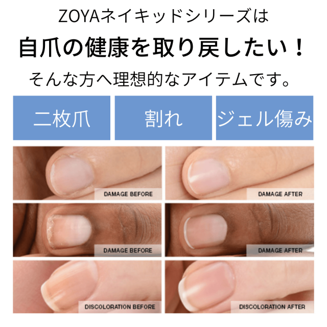 ◇ZOYA ネイキッド 自爪風マット仕上げセット◇爪強化剤 補強 成長促進