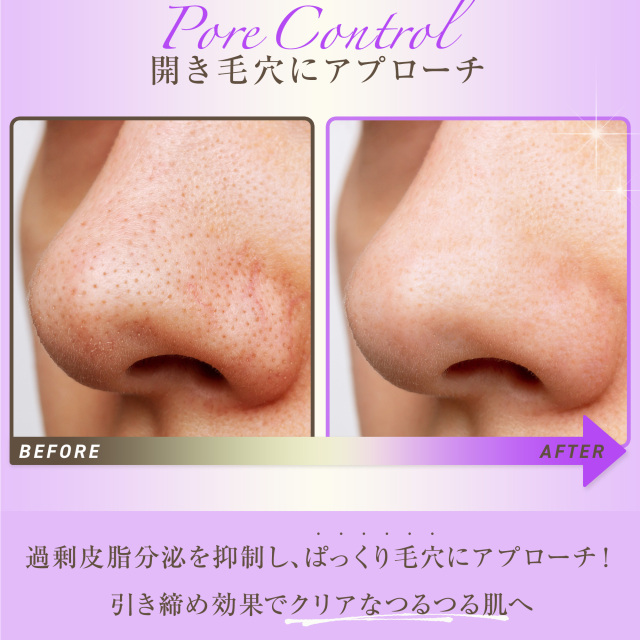 コントロールセラム