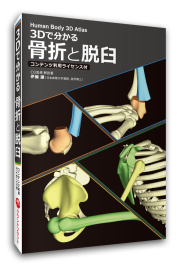 【ソフト】３Dで分かる 骨折と脱臼≪コンテンツ利用ライセンス付≫