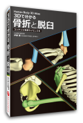 決算セール【ソフト】３Dで分かる 骨折と脱臼≪コンテンツ利用ライセンス付≫